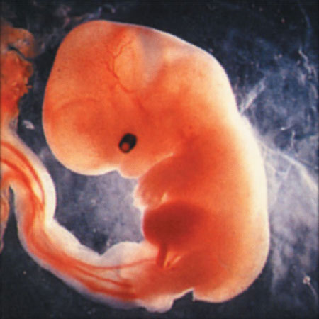 the-gender-of-a-child-determined-at-6-weeks-of-pregnancy-2